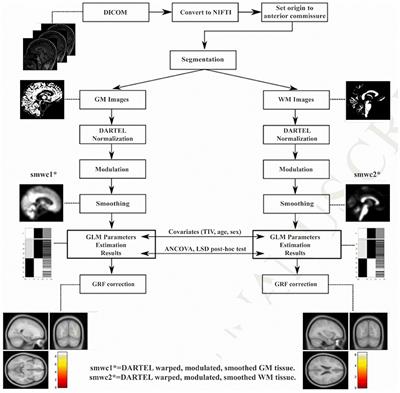 Altered Brain Morphometry in Cerebral Small Vessel Disease With Cerebral Microbleeds: An Investigation Combining Univariate and Multivariate Pattern Analyses